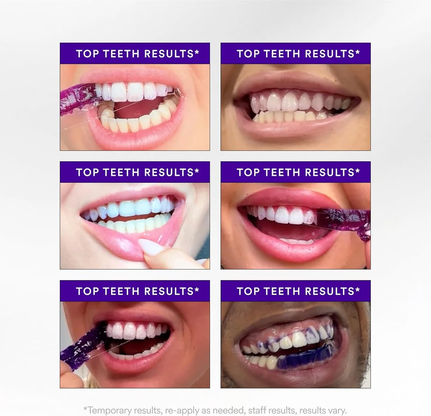 Teeth whitening stripes